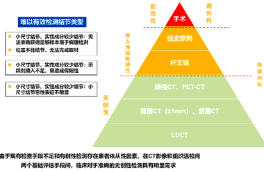 案例分享/丽菲清®（MDA TEST）助力肺癌早诊早治
